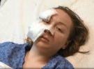 В Турции украинке 28-летней Анне Бутым муж 45-летний Месут Озтюркмен порезал лицо. Напал в торговом центре при свидетелях