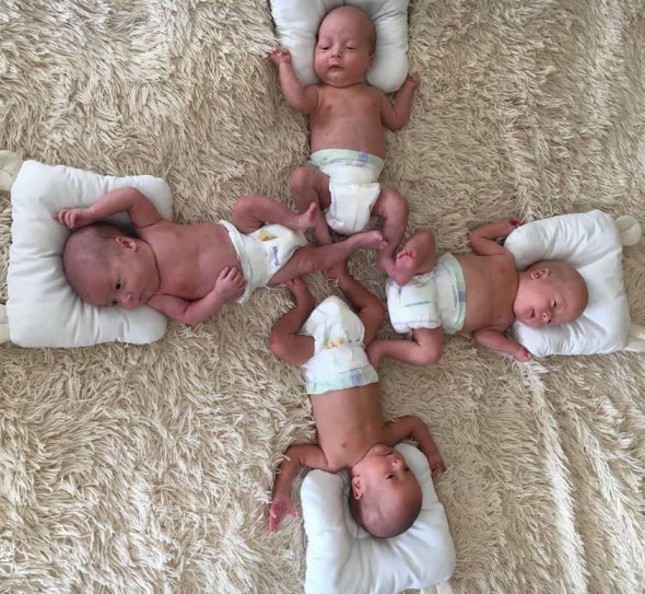 Четверня из Закарпатья: чем удивляют &quot;рожденные в рубашке&quot; младенцы |  Новости на Gazeta.ua