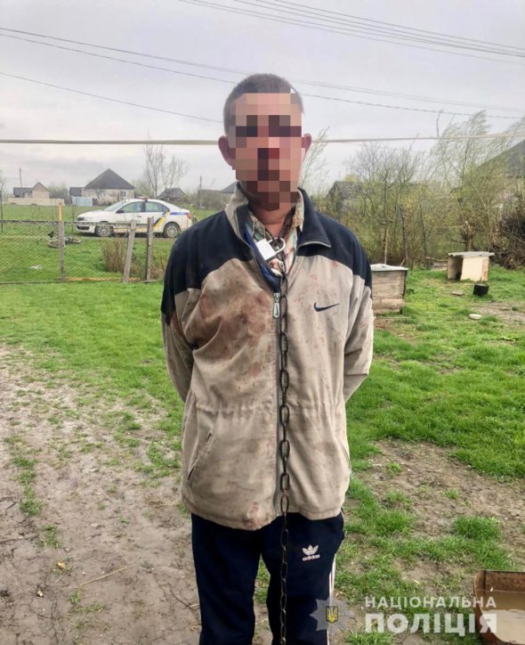 На Закарпатті 31-річного чоловіка тримав на ланцюгу знайомий
