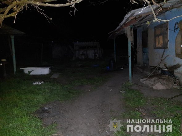 На Одещині 54-річний чоловік підпалив свою 37-річну сусідку, коли та заступилася за його дружину