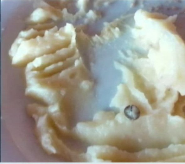 Дитина ледь не ковтнула канцелярську кнопку