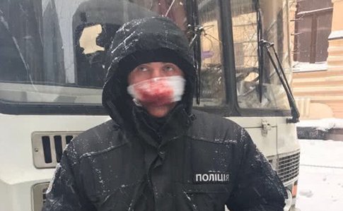 Поліцейський з розбитим носом біля Верховної Ради