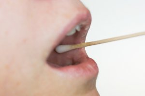 Коли вірус папіломи ”поселяється” на слизовій оболонці, то на її поверхні виникають новоутворення