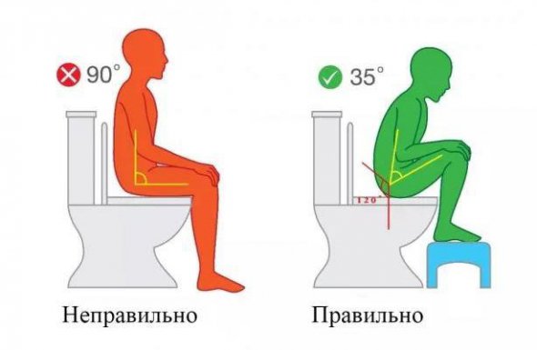 Здоровье: специалисты рассказали, как правильно ходить в туалет | Мобильная  версия | Новости на Gazeta.ua