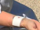 В Австралії кенгуру напав на жінку, коли вона вигулювала собаку
