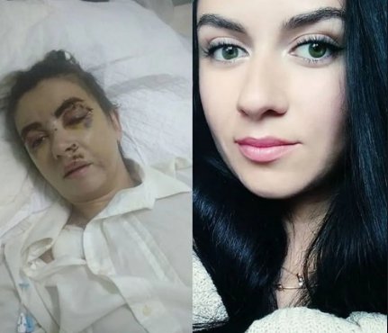 33-летнюю Ольгу Войтенко из Константиновки Донецкой области едва не забил до смерти киевлянин 45-летний Алексей Волков. Они встречались некоторое время. Но женщина сказала, что хочет прекратить отношения