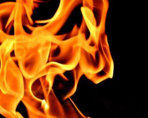 12-річний хлопчик влаштував самопідпал
