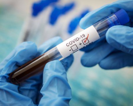 Коронавирус: в Италии 99% смертей приходится на не полностью вакцинированных - Vimarsana News