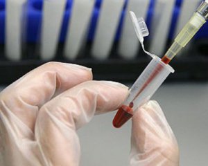Разработали анализ крови для выявления аутизма
