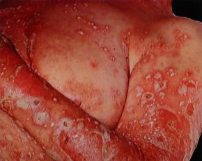 Лікар розповів про невиліковну хворобу, що вразила Кім Кардашян та Камерон Діаз