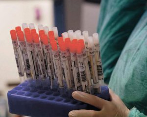 Україна встановила новий сумний рекорд з коронавірусу